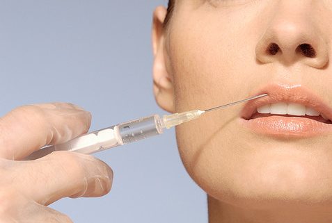 Injection d'acide hyaluronique à Marseille - DR Jauffret, chirurgie et médecine esthétique